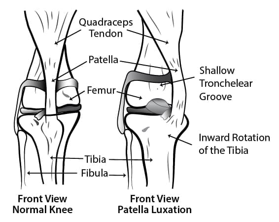 Dog knee diagram comparing a normal knee and a knee with patella luxation.